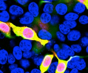 mCherry (rabbit antibody) in the group Tag Antibodies / mCherry/mNeonGreen/mStrawberry at Agrisera AB (Antibodies for research) (AS18 4179)